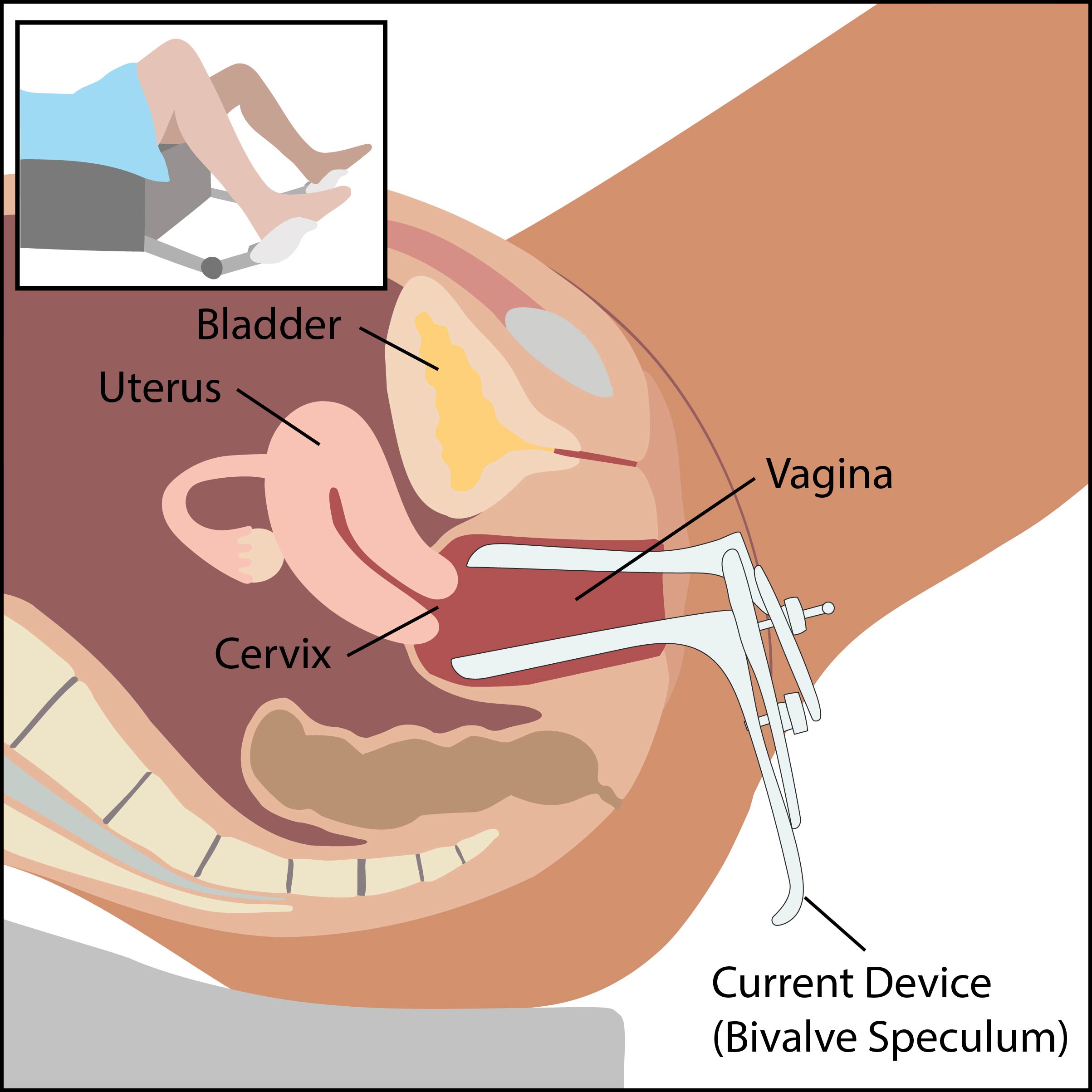 Updated screening guidelines